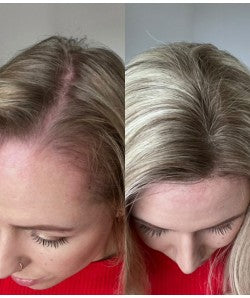 8.5” x 9” Breeze | Ultra-breathable Lace Top Human Hair Topper With Lace Front| Ponytail Topper|Low Density