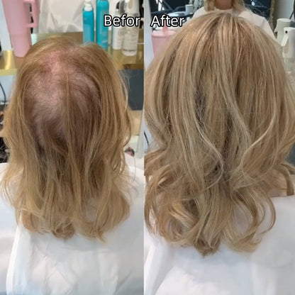 ⚡Final Hours –🌷2026 New Lightweight & Breathable Wavy Hair Topper